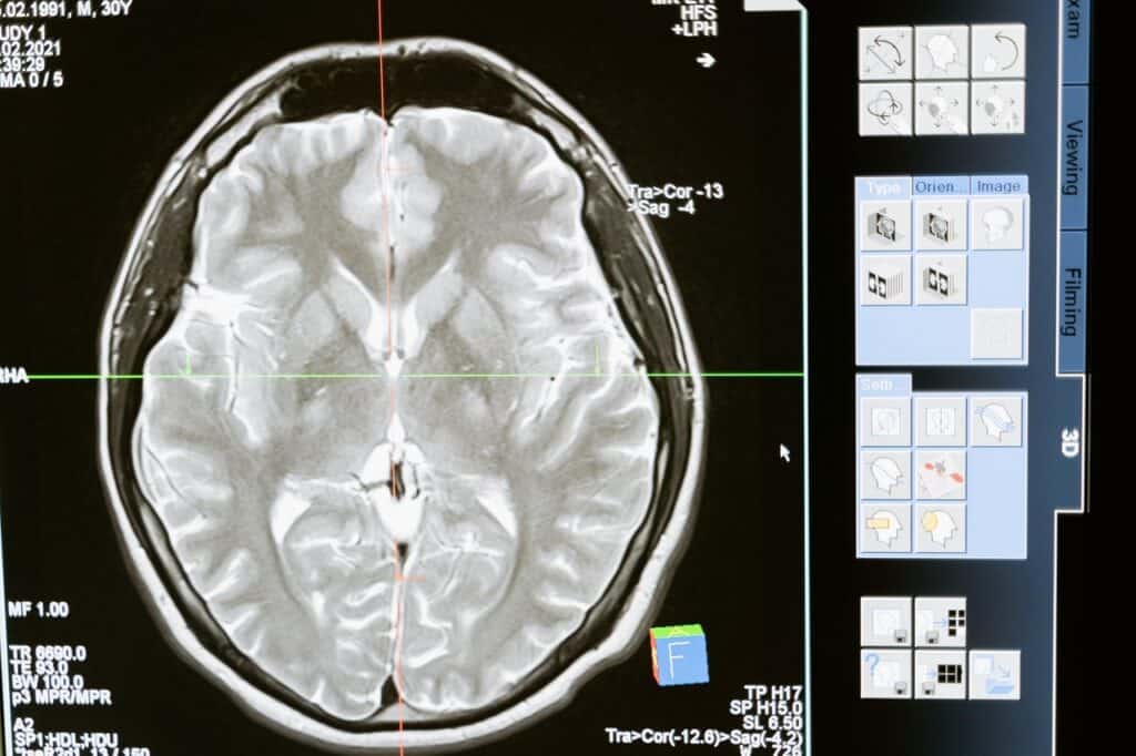 Brain - Palo Alto Neurofeedback Services